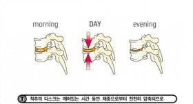 아침에 허리를 쉽게 다치는 이유